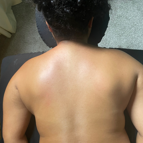#2 AFTER at RELAXING BRANDY Therapeutic Massage in Taylor, MI