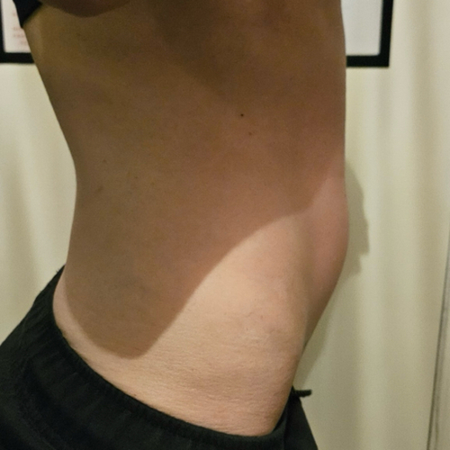 #2 AFTER Lymphatic Drainage at RELAXING BRANDY Therapeutic Massage in Taylor, MI