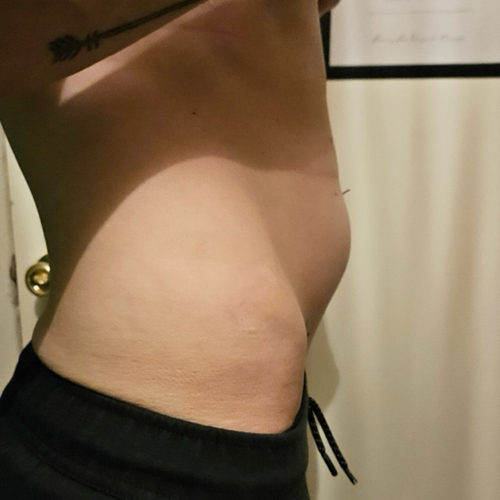 #1 BEFORE Lymphatic Drainage at RELAXING BRANDY Therapeutic Massage in Taylor, MI