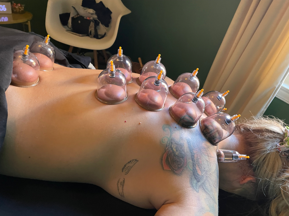 Cupping Add On! ✨ at RELAXING BRANDY Therapeutic Massage in Taylor, MI
