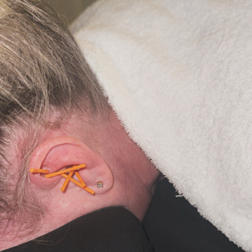 Ear Acupuncture Add On ✨ at RELAXING BRANDY Therapeutic Massage in Taylor, MI